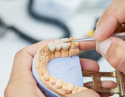 dental professional adjusting model of dental bridge 