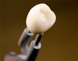 Dental crown in laboratory