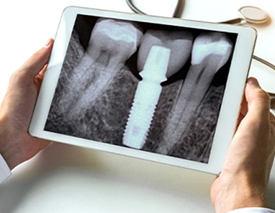 dentist looking at a dental X-ray on a tablet