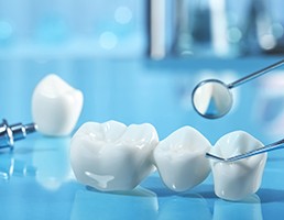 A dental bridge and a dental implant against a blue background