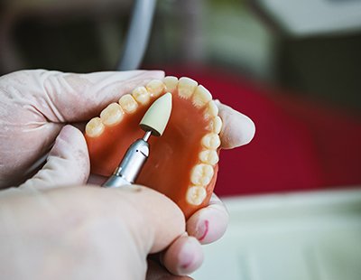 a technician working on dentures in Aspen Hill