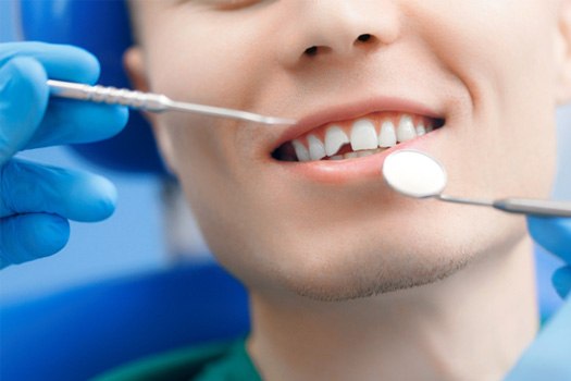 A man with a broken tooth near Glenmont