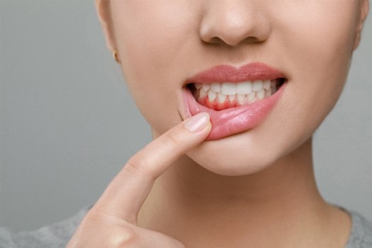 A woman with bleeding gums near Glenmont