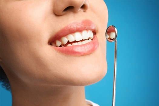 Nose-to-chin ¾ profile view of woman’s smile next to dental mirror with light blue background