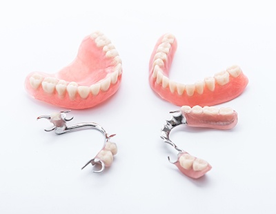 Four types of dentures