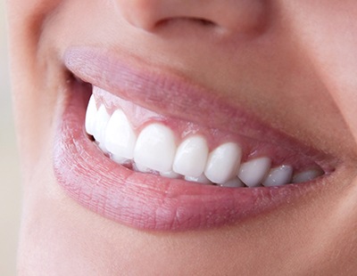 Closeup of smile after fluoride treatment