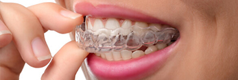 Closeup of woman placing Invisalign tray