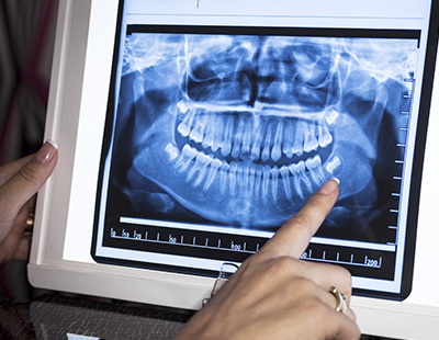 Dentist reviewing digital x-rays