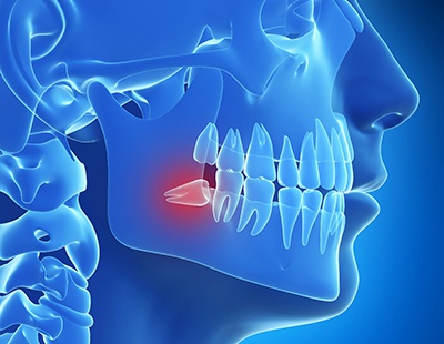 Woman with toothache at dentist's office