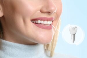 Woman smiling confidently with a dental implant