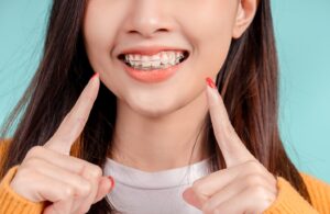 Girl smiling and wearing retainer.